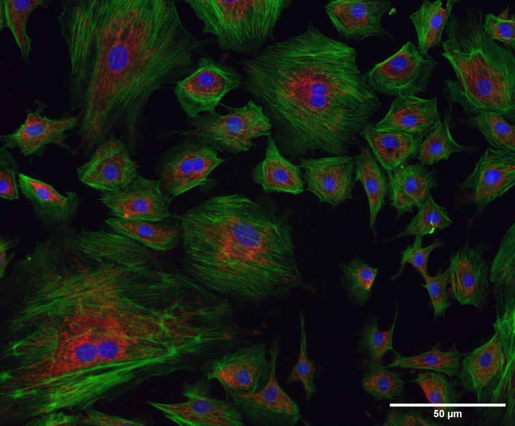 Fluorescence microscopy - image of bovine pulmonary artery endothelial (BPAE) cells