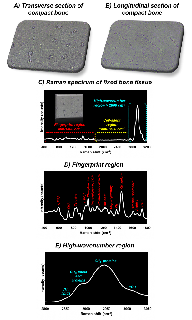 Raman spectrum used to analyse bone composition 