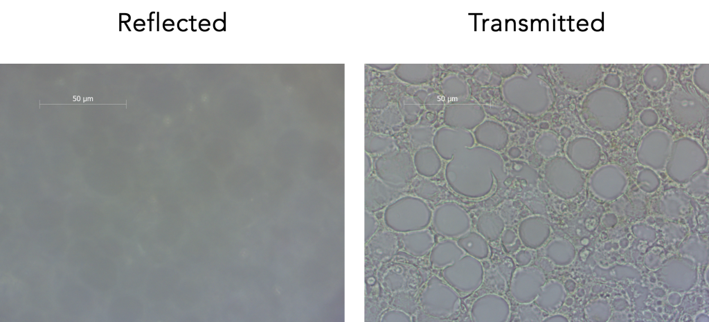 Reflected and transmitted illumination of a thin segment of fatty liver tissue